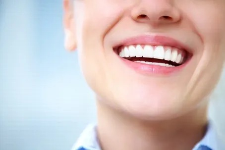 5 советов для сияющей улыбки