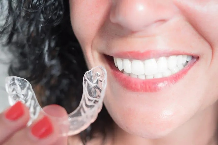 Что нужно знать об Invisalign